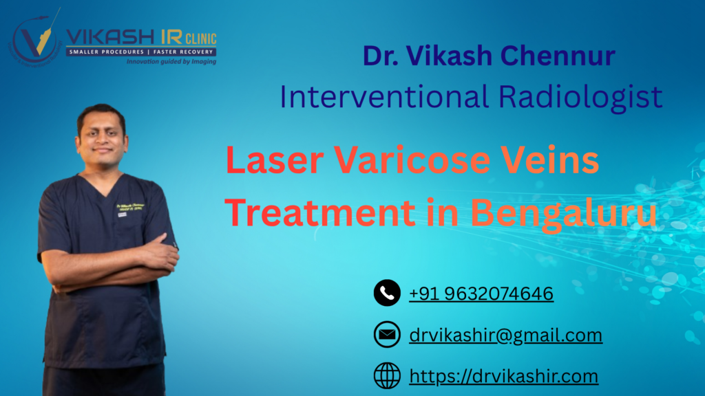 Laser Varicose Veins Treatment in Bengaluru