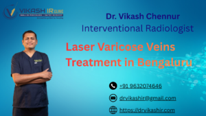 Laser Varicose Veins Treatment in Bengaluru