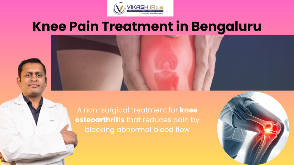 knee pain treatment in Bengaluru