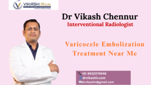Best Varicocele Embolization Treatment in Bengaluru