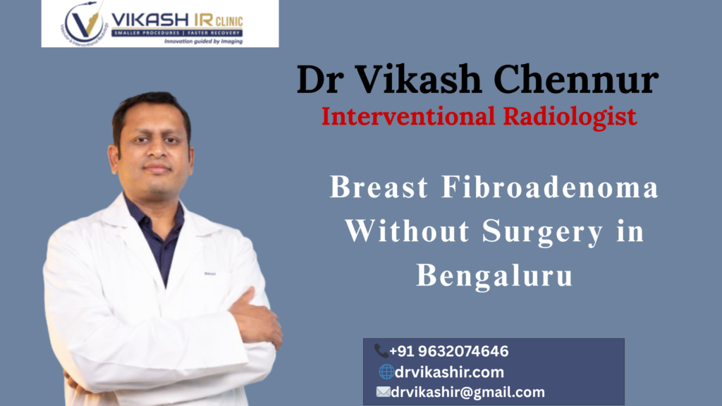 Breast Fibroadenoma Without Surgery in Bengaluru