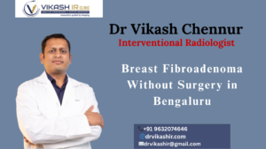 Breast Fibroadenoma Without Surgery in Bengaluru
