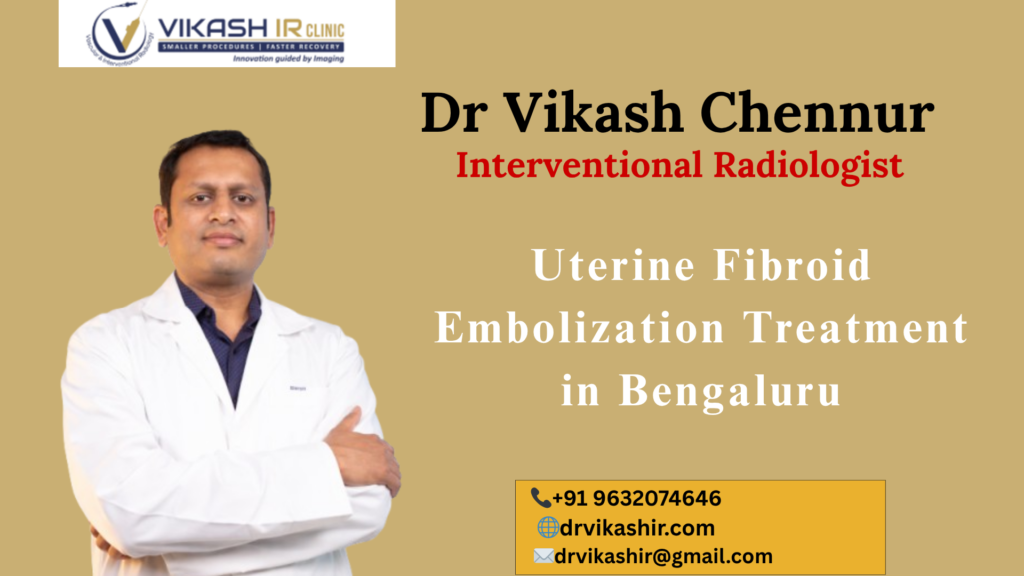 uterine fibroid treatment without surgery