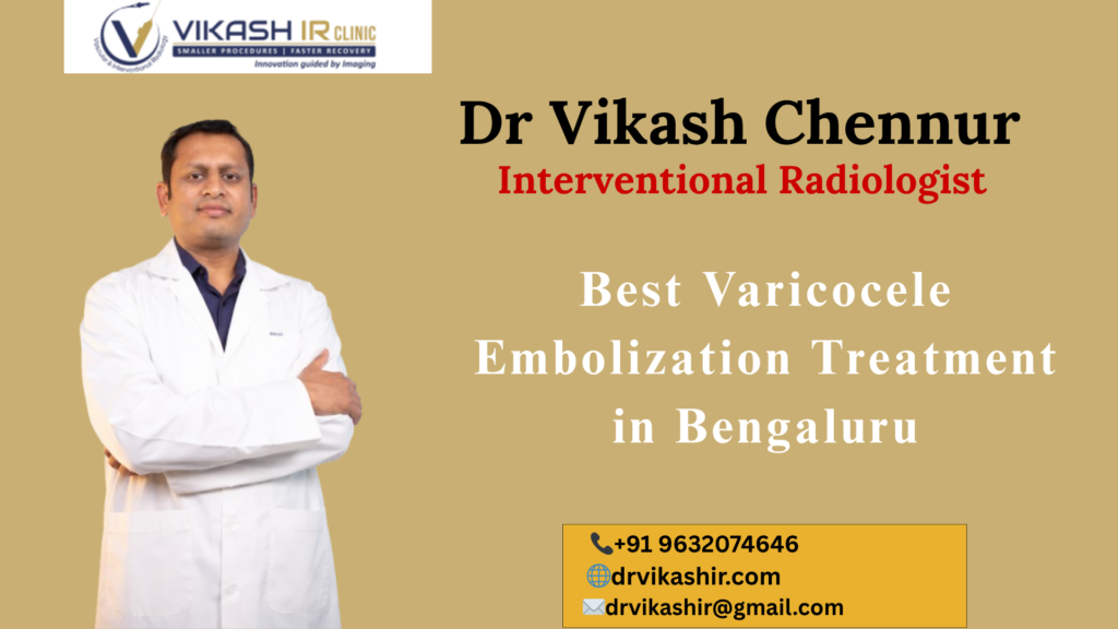 Best Varicocele Embolization Treatment in Bengaluru