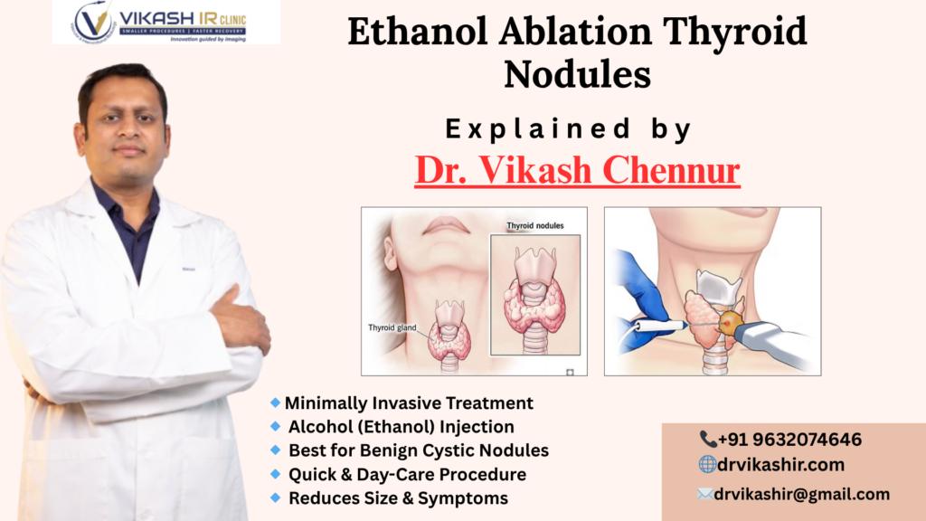 Ethanol Ablation of Thyroid Nodules in Bangalore
