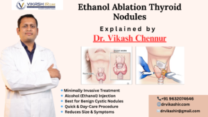 Ethanol Ablation of Thyroid Nodules in Bangalore