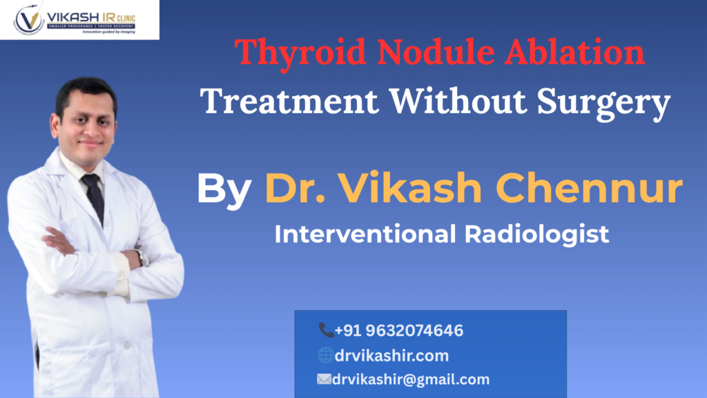 Thyroid Nodule Ablation Treatment Without Surgery
