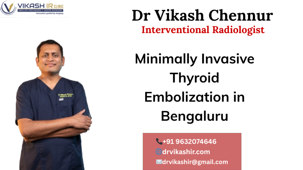 Minimally Invasive Thyroid Embolization in Bengaluru