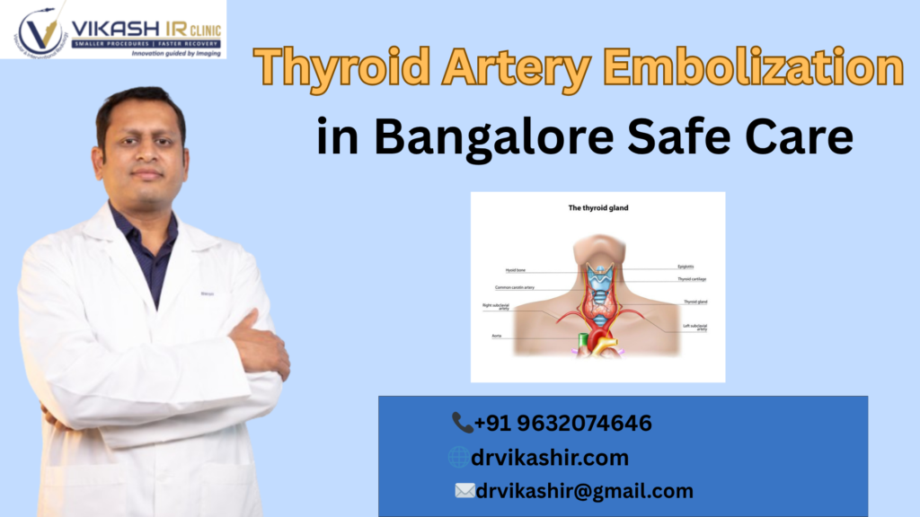 Thyroid artery embolization in bangalore safe care