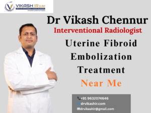 uterine fibroid embolization treatment in Bengaluru