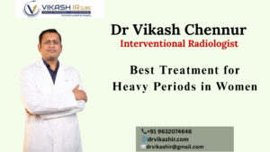Best Treatment for Heavy Periods in Women