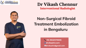 Best Non-Surgical Fibroid Embolization in Bengaluru