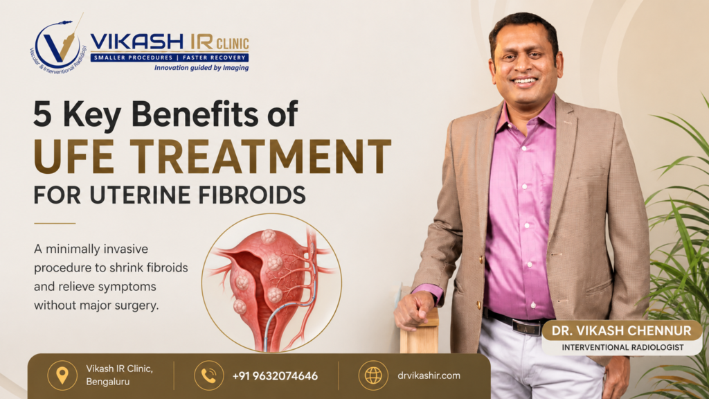 5 Key Benefits of UFE Treatment for Uterine Fibroids