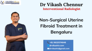 Non-Surgical Uterine Fibroid Treatment in Bengaluru