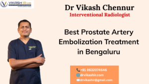 Best Prostate Artery Embolization Treatment in Bengaluru