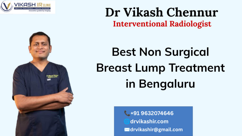 Non-Surgical Breast Lump Treatment in Bengaluru