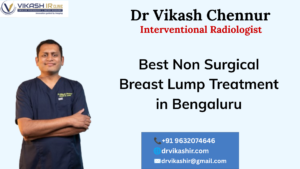Non-Surgical Breast Lump Treatment in Bengaluru