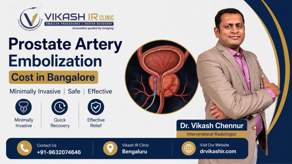 Prostate Artery Embolization Cost in Bangalore Prostate Artery Embolization Cost in Bangalore