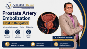 Prostate Artery Embolization Cost in Bangalore Prostate Artery Embolization Cost in Bangalore