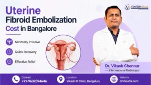 Uterine Fibroid Embolization Cost in Bangalore Uterine Fibroid Embolization Cost in Bangalore