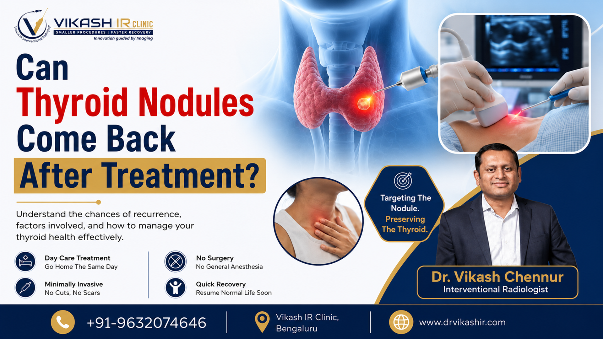 Can Thyroid Nodules Come Back After Treatment? Can Thyroid Nodules Come Back After Treatment