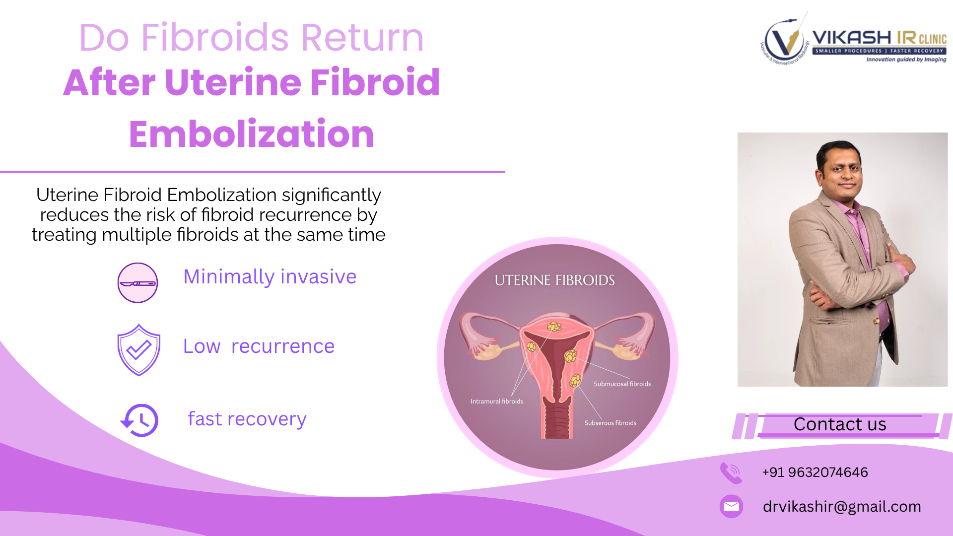 Do Fibroids Return After Uterine Fibroid Embolization (UFE)? Uterine Fibroid Embolization (UFE)?