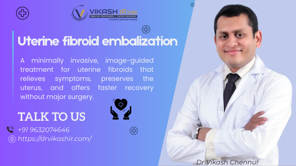 Uterine Fibroid Embolization (UFE)?