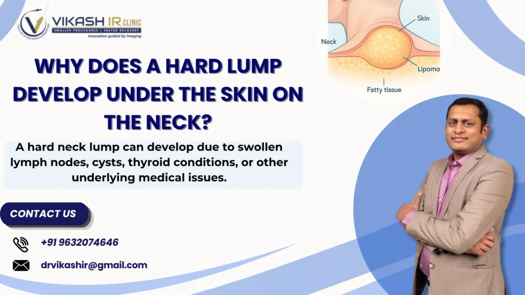 Hard Lump Under Neck Skin Causes & Treatment