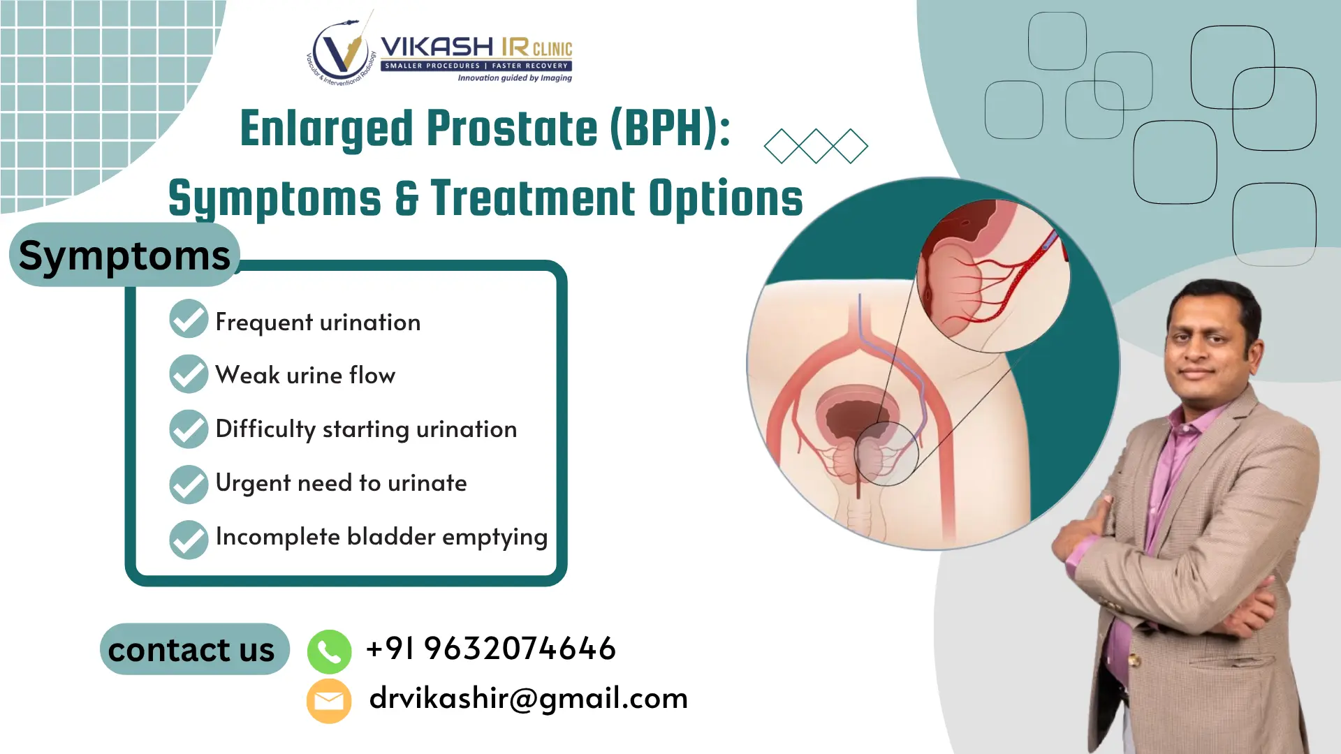 Enlarged Prostate (BPH): Symptoms & Treatment Options Enlarged Prostate (BPH): Symptoms & Treatment Options