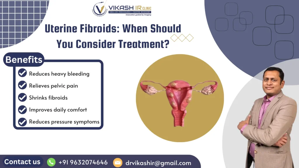 When to Consider Uterine Fibroid Treatment