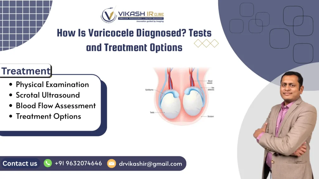 Varicocele treatment