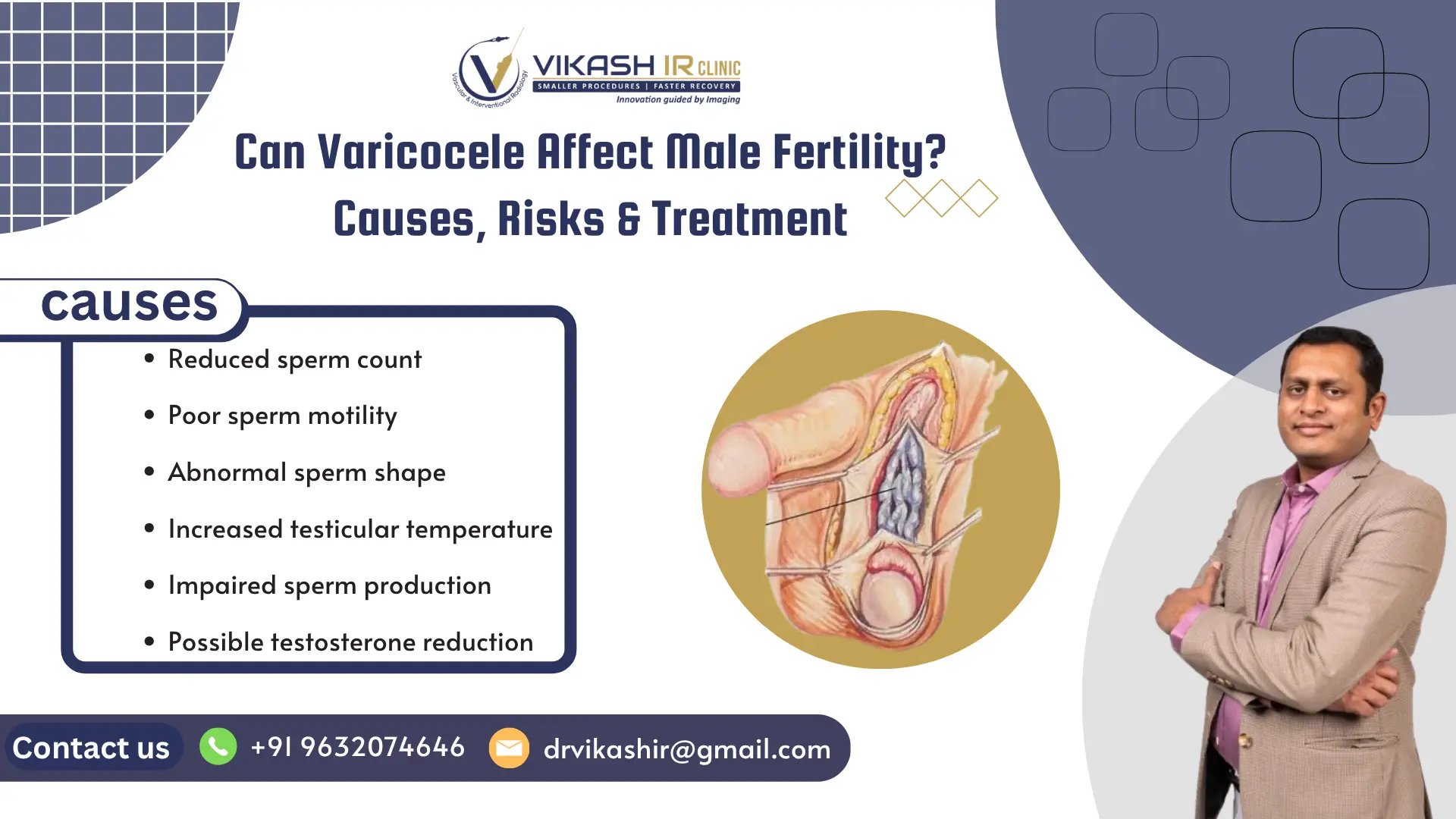 Can Varicocele Affect Male Fertility? Causes, Risks & Treatment Varicocele Affect Male Fertility