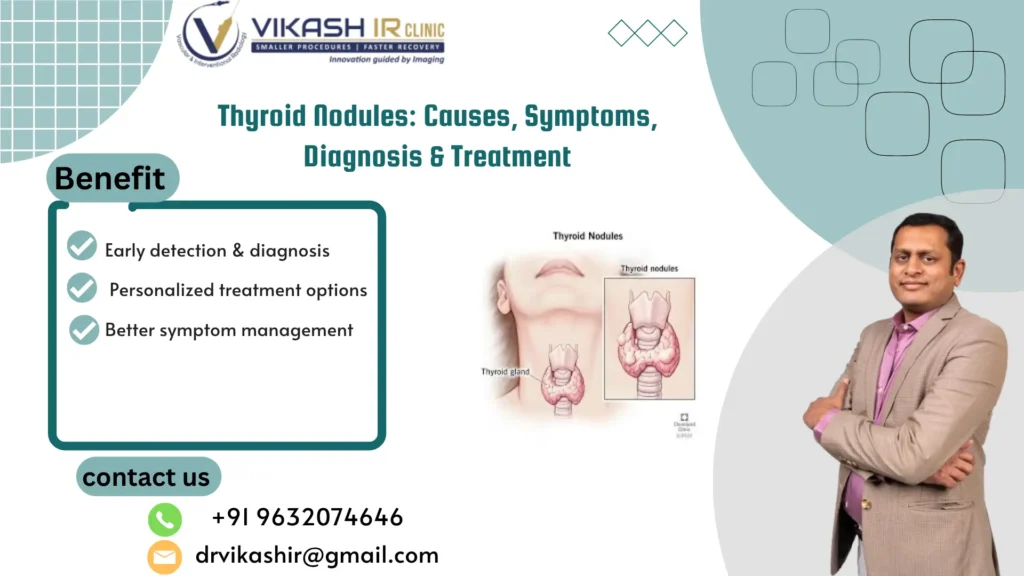 Thyroid Nodules: Causes, Symptoms, Diagnosis & Treatment